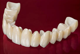 Dental Crowns & Bridge In Airoli | Zirconia Crowns In Airoli | Smile Care Dental Clinic